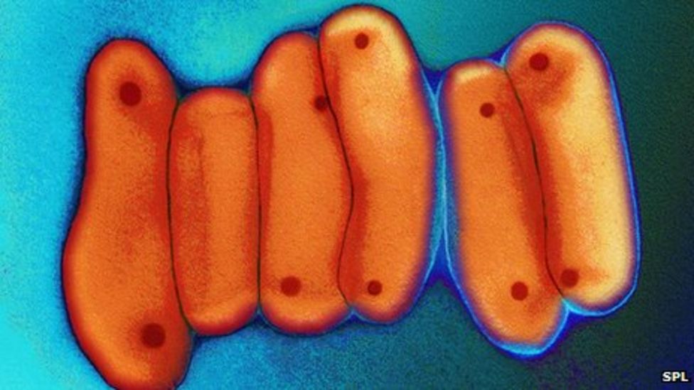 New antimalaria drug developed at Dundee University BBC News