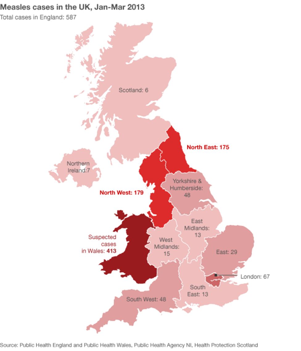 Measles outbreak in maps and graphics BBC News