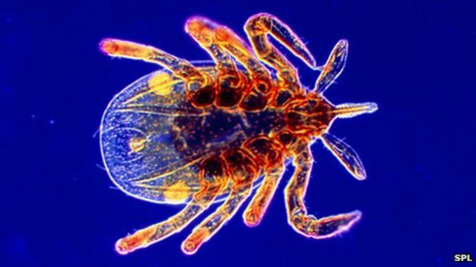 Ignorance of tickborne Lyme disease 'costing lives' BBC News