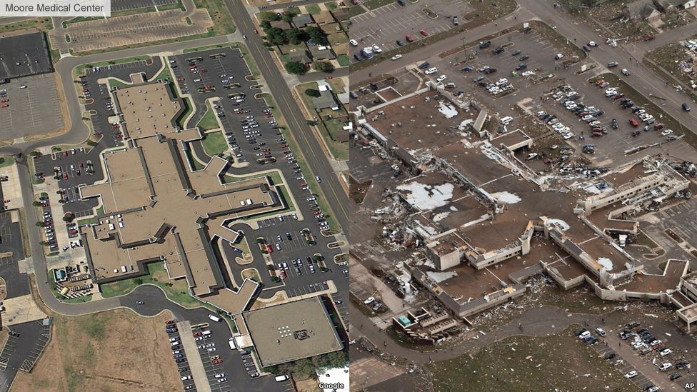 Before and after image of Moore Medical Center, Oklahoma City