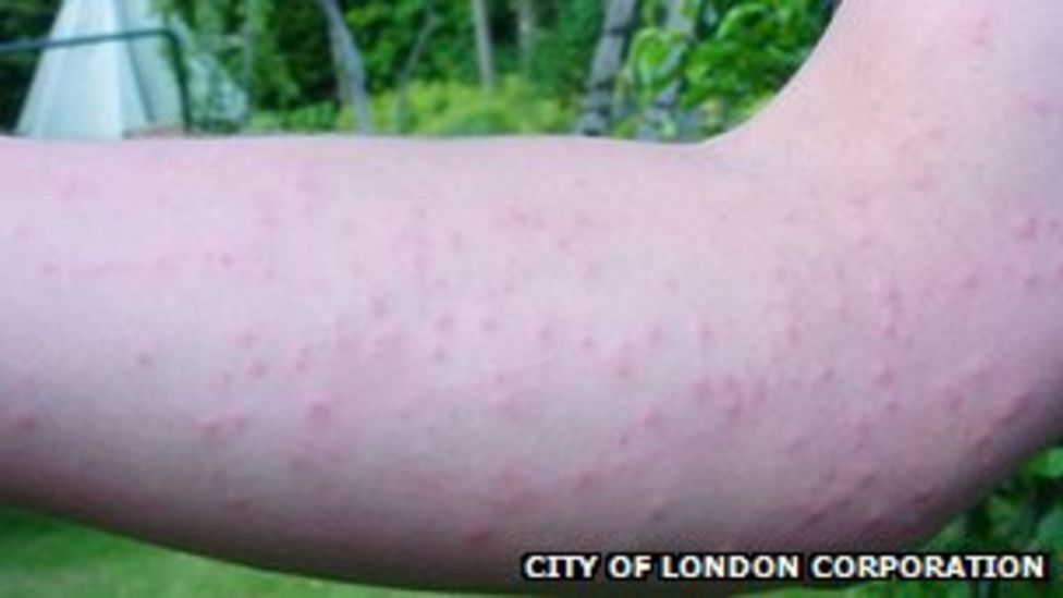 Tree disease 'threatening' City of London BBC News