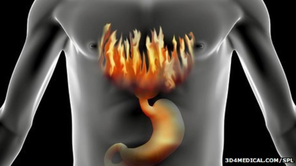 Ulcer drugs linked to vitamin B12 deficiency BBC News