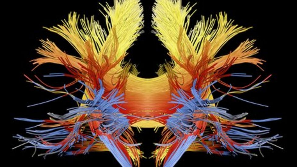 Brains White Matter More Than Just Fat The Surprising Facts - j2l0yke