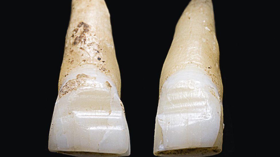 Filed teeth discovered at the Weymouth grave