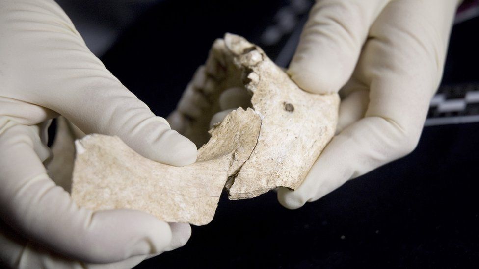 Jaw of skull found in mass grave in Weymouth