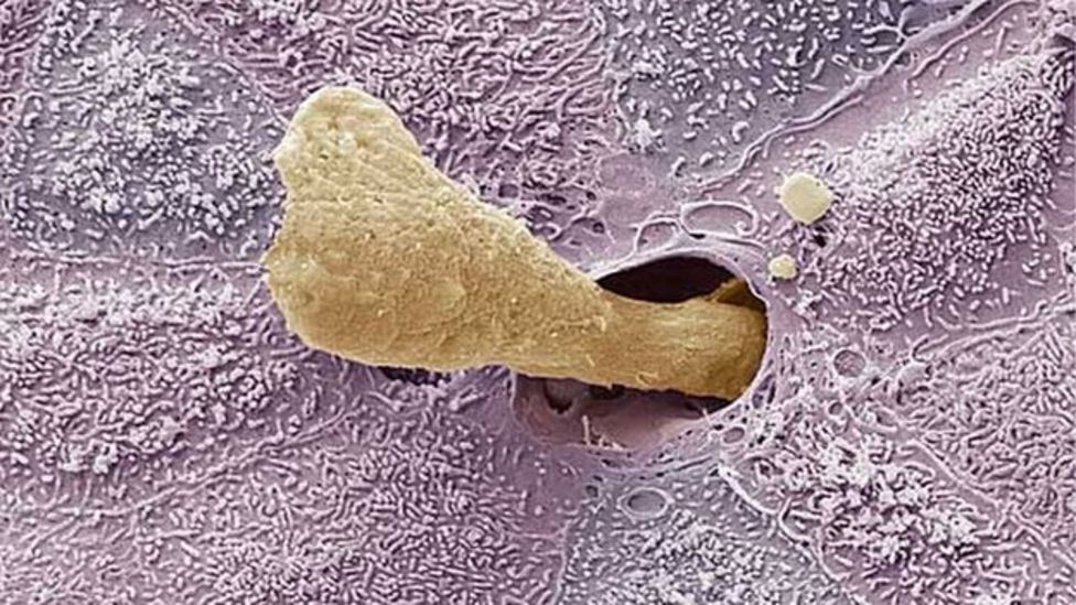 Secretion secrets things you didn’t know about ear wax BBC News