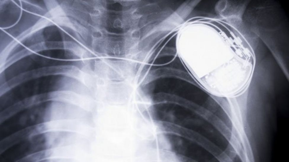 Rare earths Neither rare, nor earths BBC News