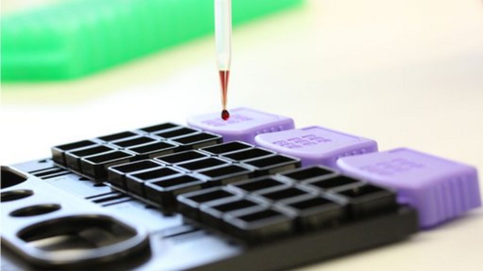 Randox expands toxicology service by buying Manchester lab BBC News