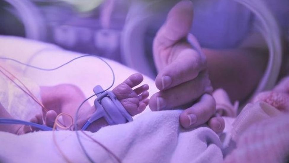 Warning over plastics used in treating premature babies BBC News