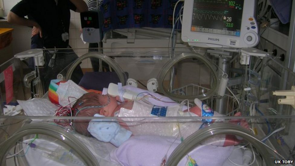 Cooling babies 'helps reduce longerterm brain damage' BBC News