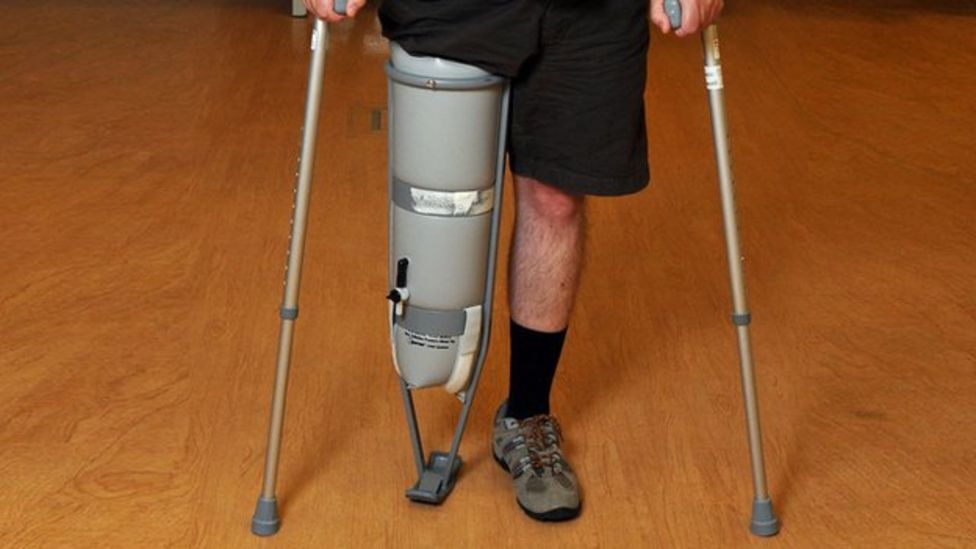 Lesserknown things about prosthetic legs BBC News