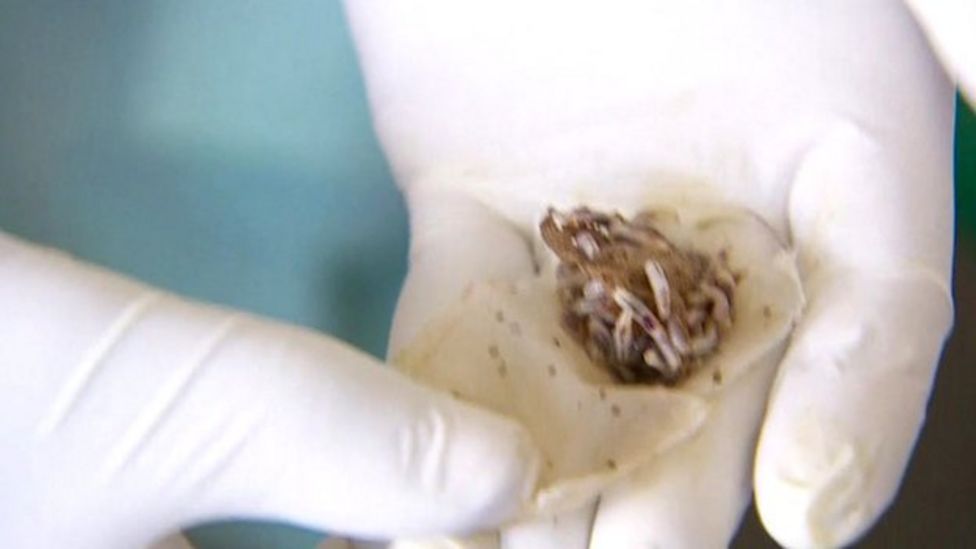 How Maggots Can Lower Kenyan Hospital Bills - Bbc News