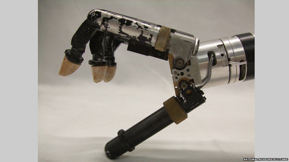 Bionic arm