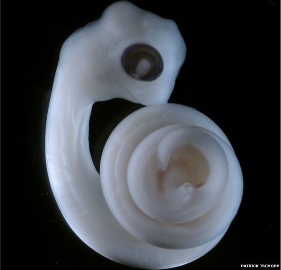 Limb Cells Turned Into Genitals In Lab Bbc News 