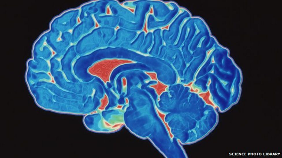 Poorer children 'have smaller brains', researchers say BBC News