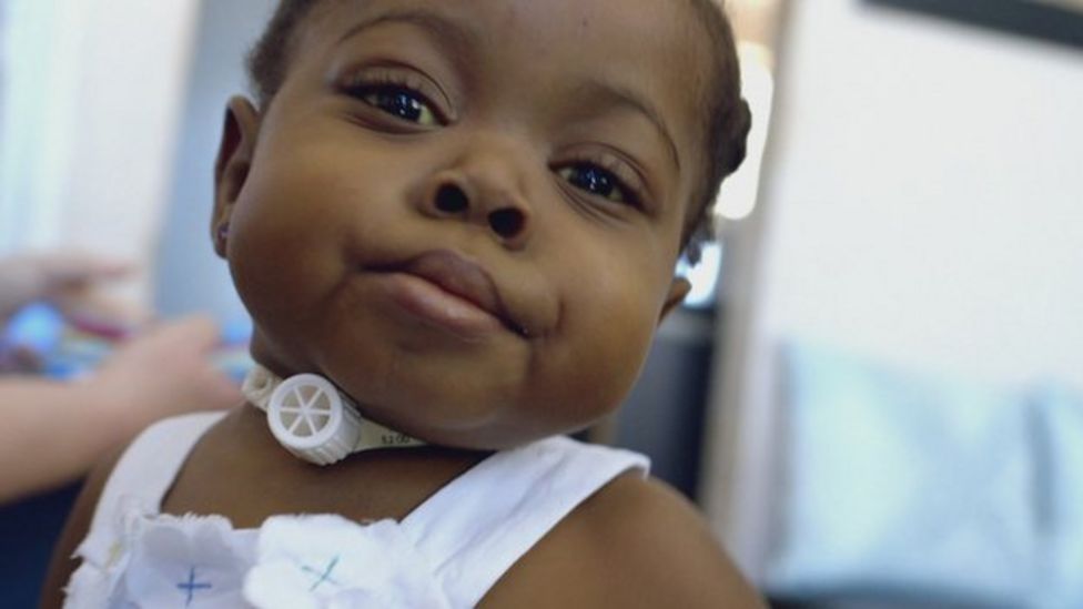 Giving newborns 'air to breathe' BBC News