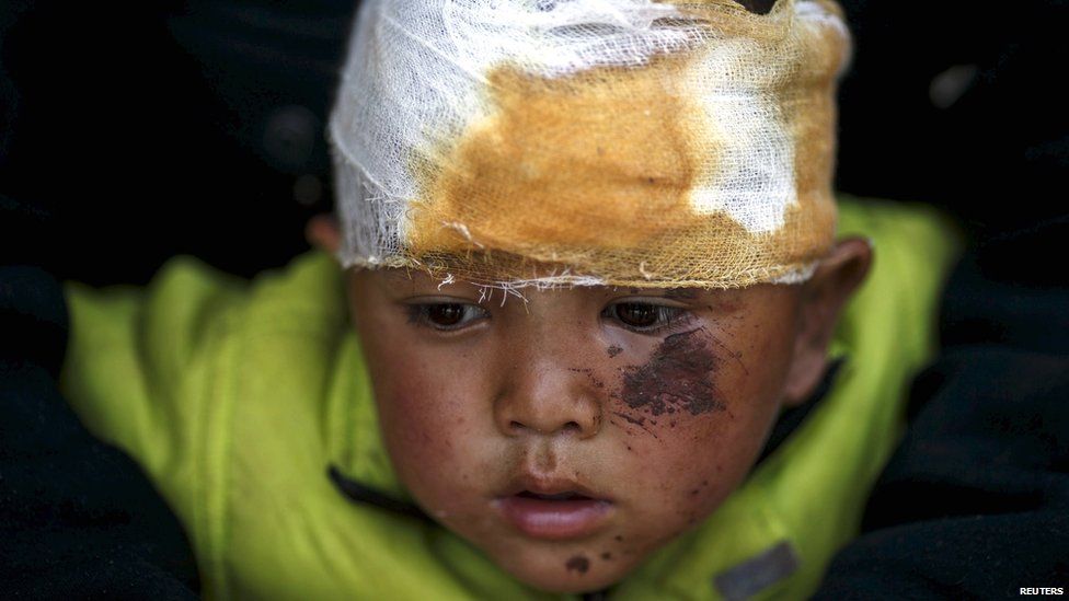 Abhishek Tamang, 4, looks on after receiving medical treatment, following Saturday's earthquake, at Dhading hospital, in Dhading Besi (27 April 2015)
