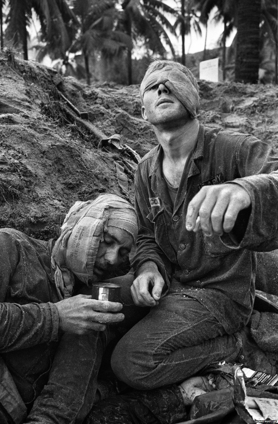 First Cavalry Division medic Thomas Cole with one of his own eyes bandaged, continues to treat wounded Staff Sgt. Harrison Pell during a 30 January 1966 fire fight at An Thi in the Central Highlands between US troops and a combined North Vietnamese and Vietcong force
