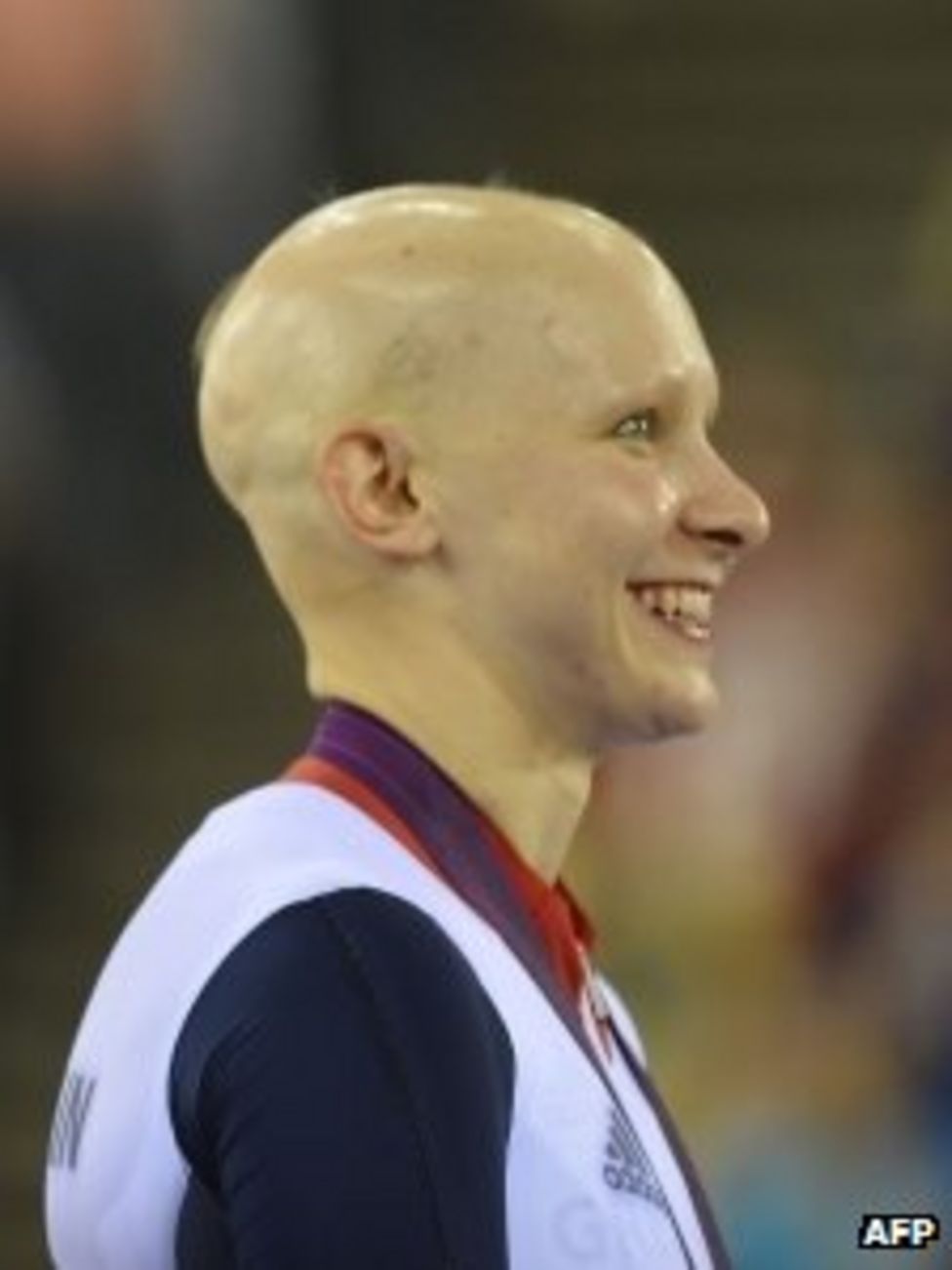 Olympic cyclist Joanna Rowsell's hair loss inspiration hope BBC News