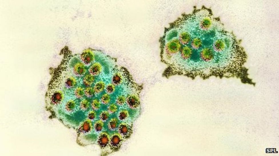 'One in five' struck by norovirus in Scotland, say experts BBC News