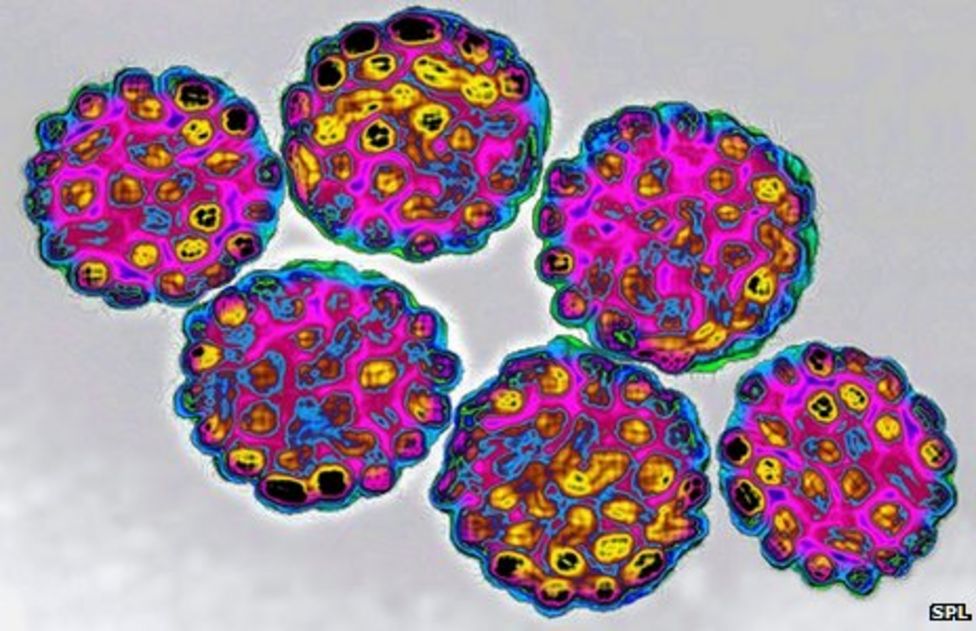 Newsbeats Guide To Hpv Virus Bbc News 9786