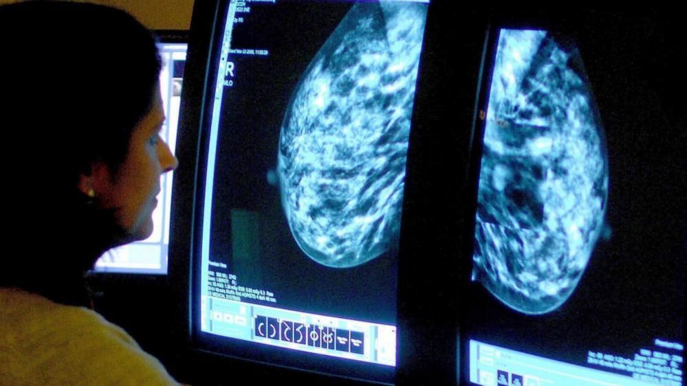 A woman examining a breast scan