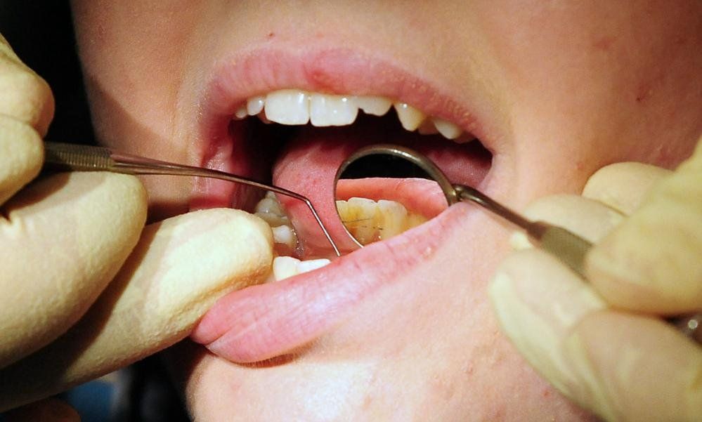 Child's mouth being examined by a dentis