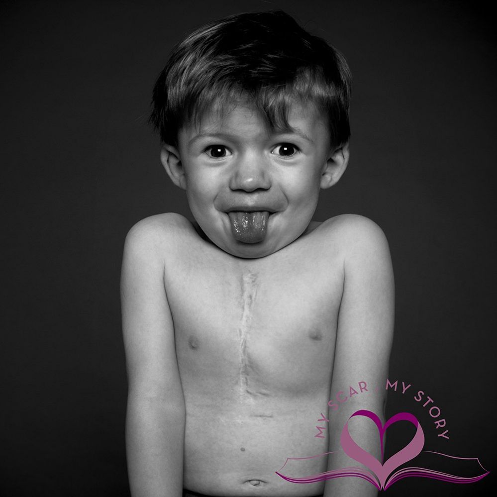 'You should be proud of your scar' BBC News