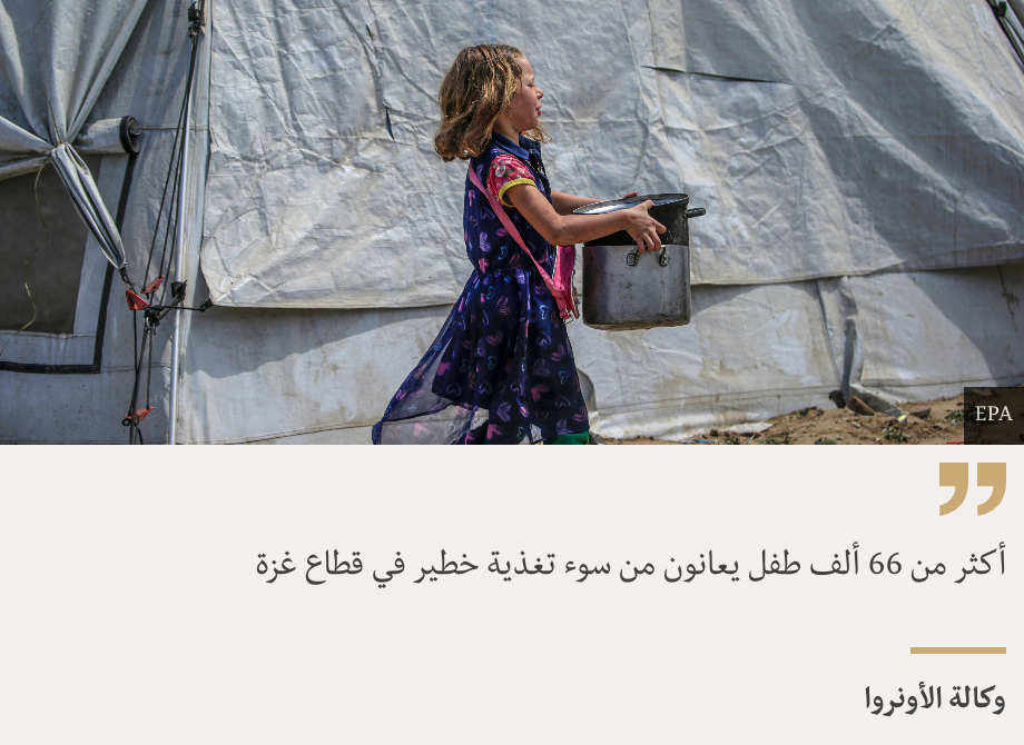 "أكثر من 66 ألف طفل يعانون من سوء تغذية خطير في قطاع غزة", Source: وكالة الأونروا, Source description: , Image: 
