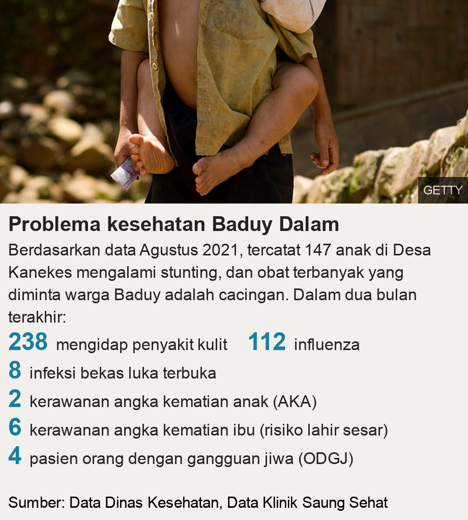 Problema kesehatan Baduy Dalam. Berdasarkan data Agustus 2021, tercatat 147 anak di Desa Kanekes mengalami stunting, dan obat terbanyak yang diminta warga Baduy adalah cacingan. Dalam dua bulan terakhir: [ 238 mengidap penyakit kulit ],[ 112 influenza ],[ 8 infeksi bekas luka terbuka ],[ 2 kerawanan angka kematian anak (AKA) ],[ 6 kerawanan angka kematian ibu (risiko lahir sesar) ],[ 4 pasien orang dengan gangguan jiwa (ODGJ) ], Source: Sumber: Data Dinas Kesehatan, Data Klinik Saung Sehat, Image: Anak-anak suku Baduy