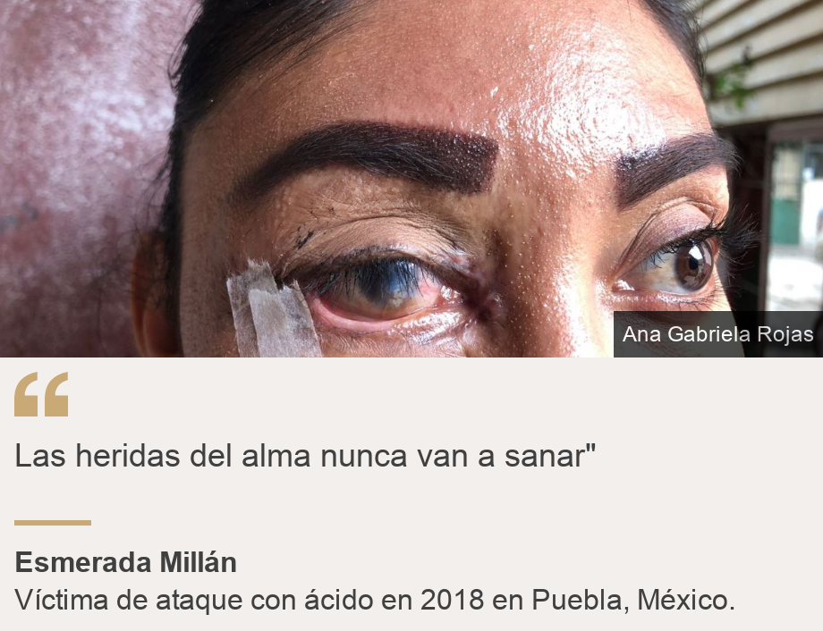"Las heridas del alma nunca sanarán"", Fuente: Esmerada Millán, Descripción de la fuente: Víctima de un ataque con ácido en 2018 en Puebla, México.  , Imagen: Primera vista de Esmeralda Millán. 