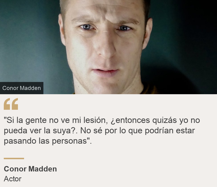 ""Si la gente no ve mi lesión, ¿entonces quizás yo no pueda ver la suya?. No sé por lo que podrían estar pasando las personas".", Source: Conor Madden, Source description: Actor, Image: 