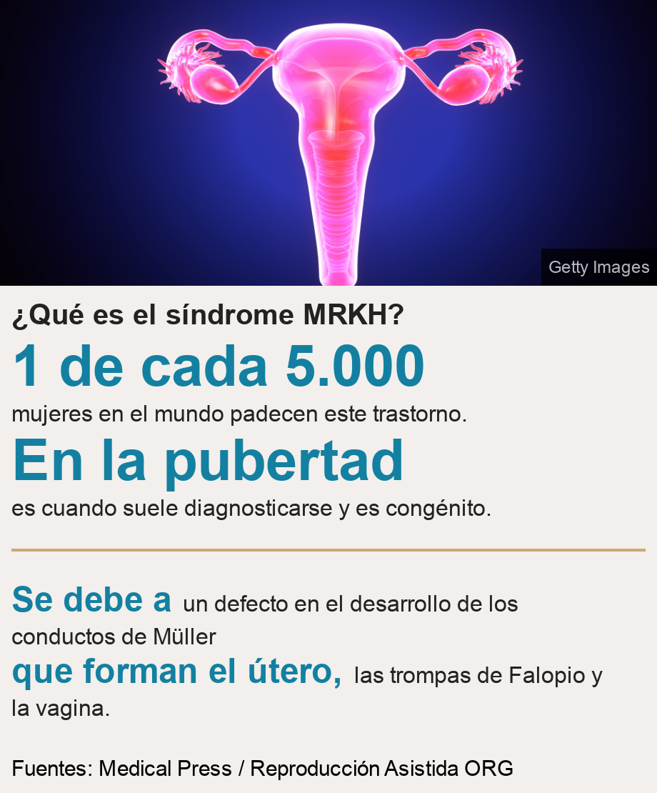 ¿Qué es el síndrome MRKH?. [ 1 de cada 5.000 mujeres en el mundo padecen este trastorno. ],[ En la pubertad es cuando suele diagnosticarse y es congénito. ] [ Se debe a un defecto en el desarrollo de los conductos de Müller ],[ que forman el útero, las trompas de Falopio y la vagina. ], Source: Fuentes: Medical Press / Reproducción Asistida ORG, Image: Útero