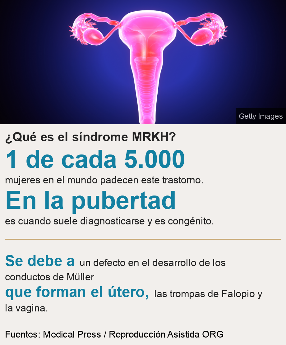 ¿Qué es el síndrome MRKH?.  [ 1 de cada 5.000 mujeres en el mundo padecen este trastorno. ],[ En la pubertad es cuando suele diagnosticarse y es  congénito. ] [ Se debe a  un defecto en el desarrollo de los conductos de Müller  ],[ que forman el útero, las trompas de Falopio y la vagina. ], Source: Fuentes:  Medical Press / Reproducción Asistida ORG, Image: Útero