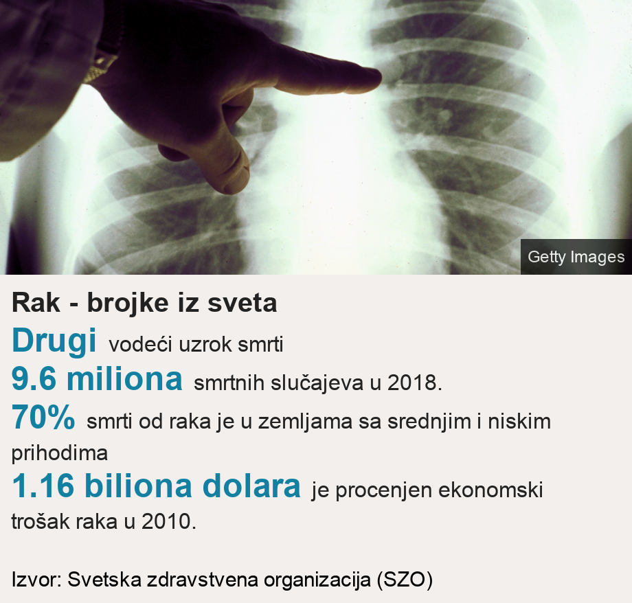 Rak - brojke iz sveta.   [ Drugi  vodeći uzrok smrti  ],[ 9.6 miliona smrtnih slučajeva u 2018. ],[ 70% smrti od raka je u zemljama sa srednjim i niskim prihodima ],[ 1.16 biliona dolara je procenjen ekonomski trošak raka u 2010. ], Source: Izvor: Svetska zdravstvena organizacija (SZO), Image: X-ray scan of the lungs of a smoker.