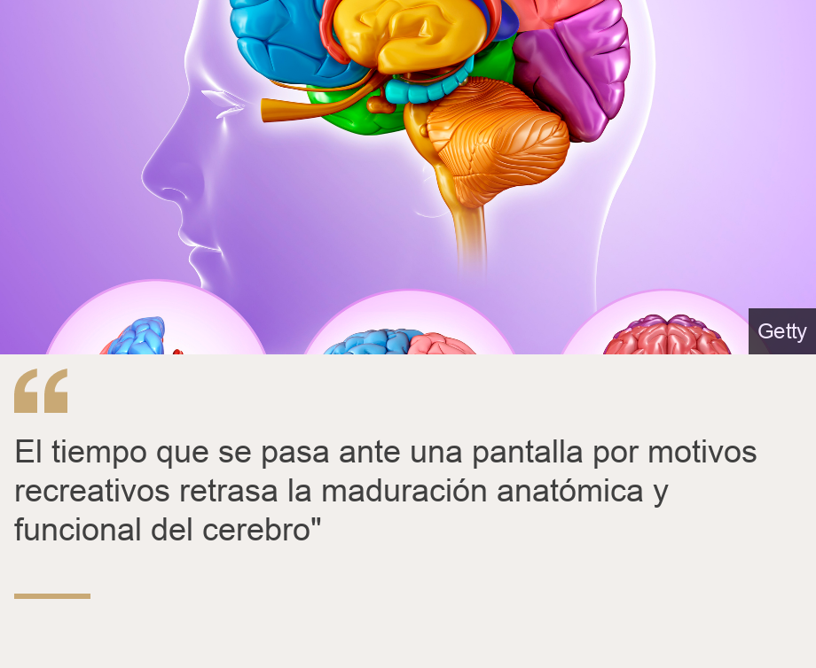 "El tiempo que se pasa ante una pantalla por motivos recreativos retrasa la maduración anatómica y funcional del cerebro"", Source: , Source description: , Image: