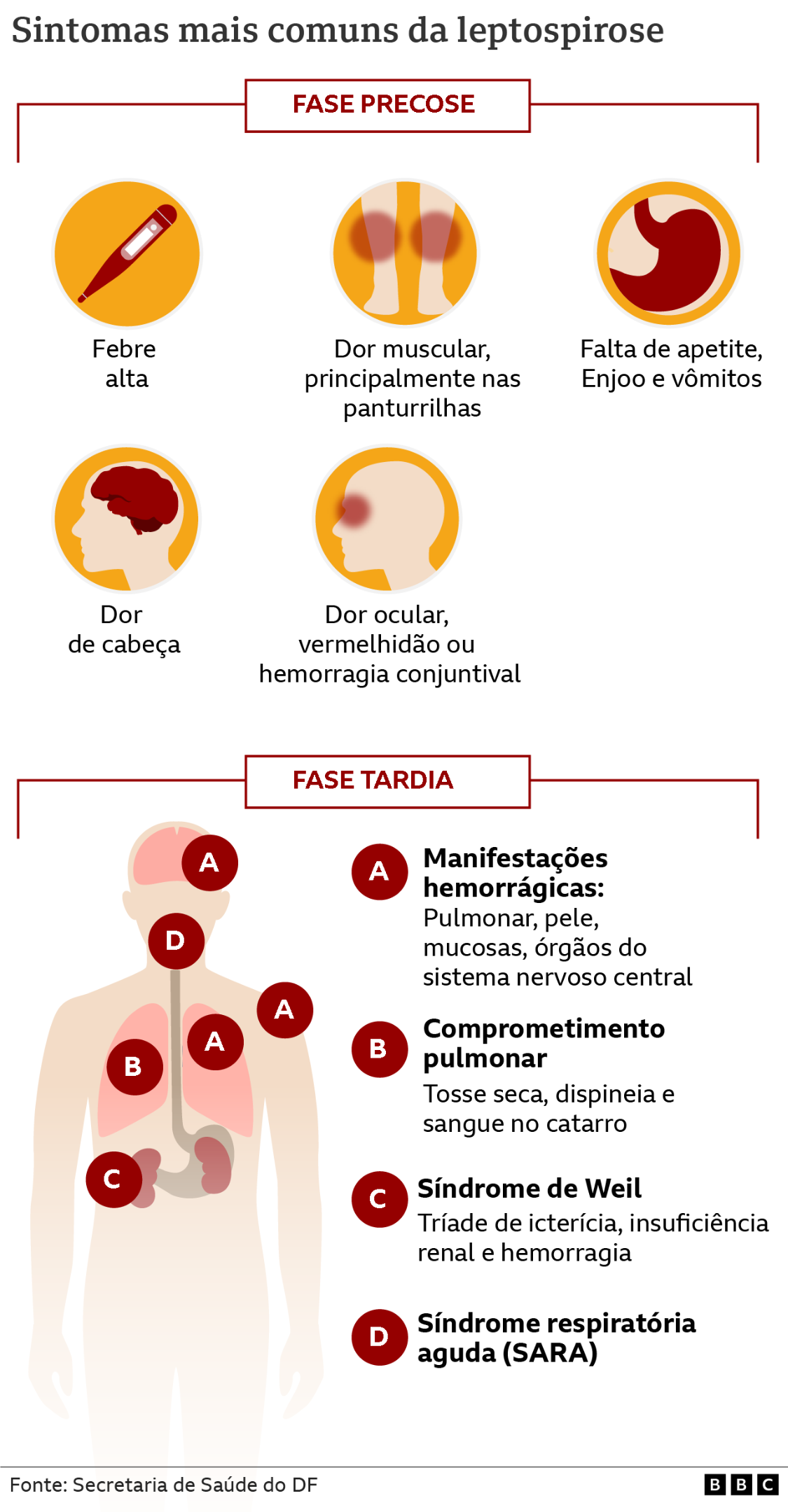 grafico mostra os sintomas da leptospirose