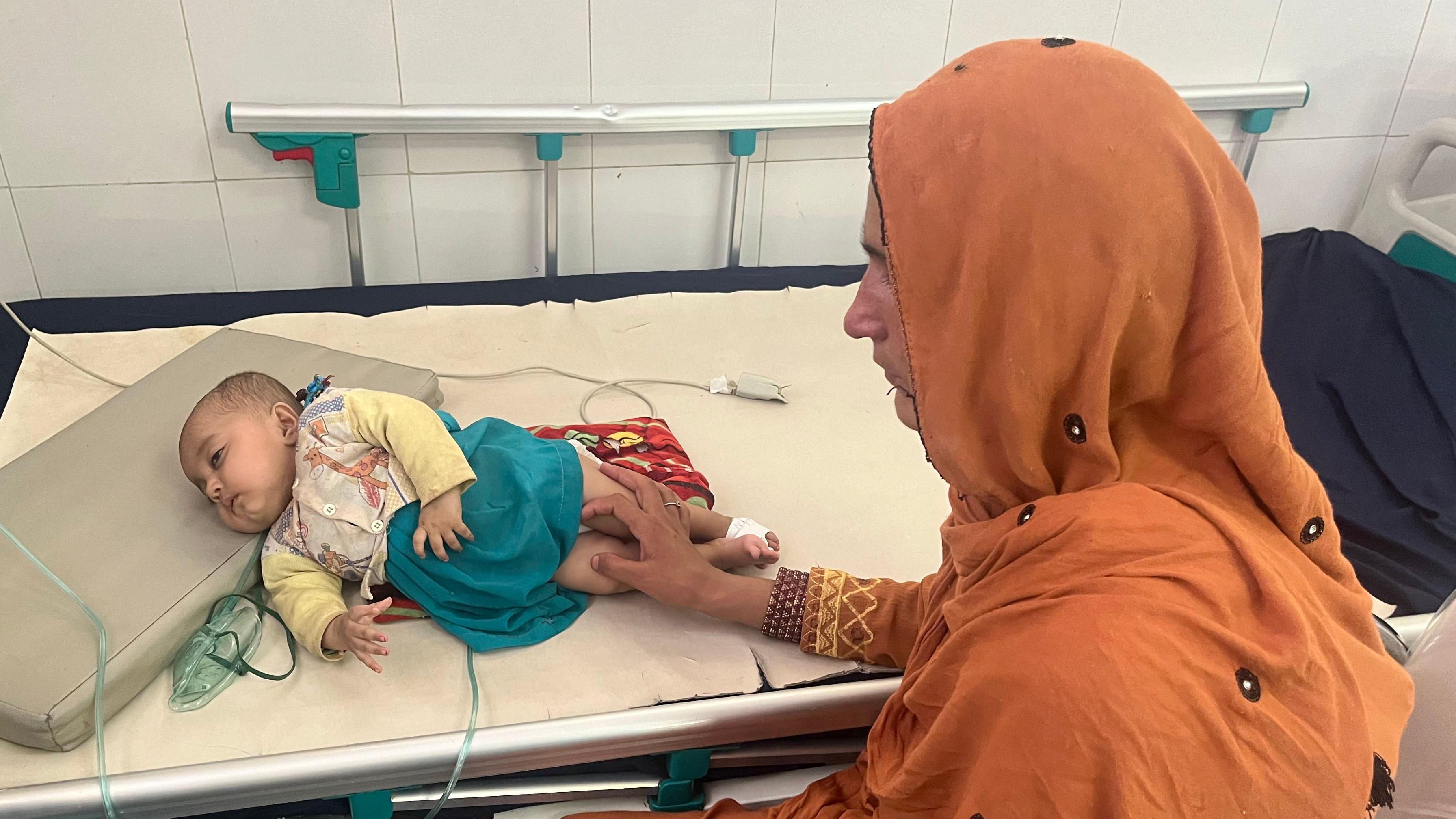 Bayi kelaparan di Afghanistan