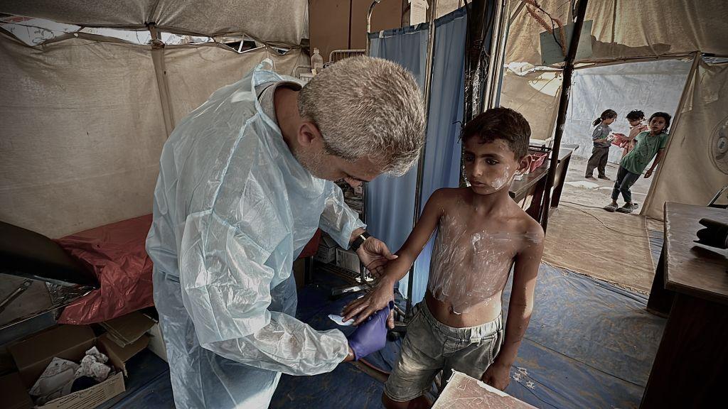 Un sanitario trata a un niño con una enfermedad de la piel.
