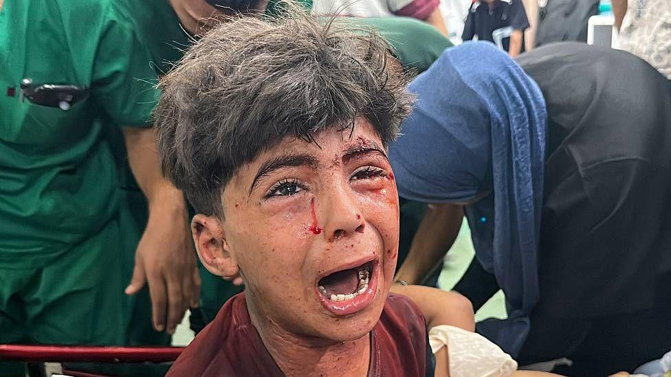 Niño herido en Gaza