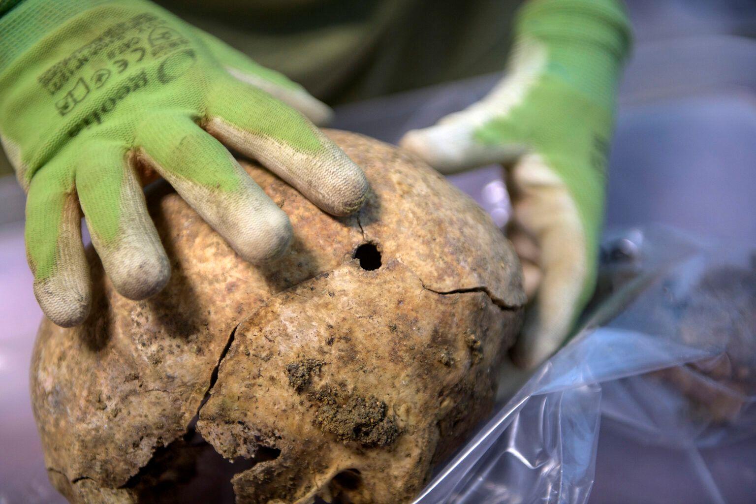 Muestra de un cráneo de una de los exhumados con un impacto de bala 