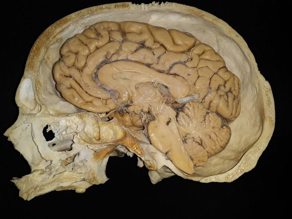 Imagem do interior de um crânio, exibida no museu de Anatomia e Plastinação da UFC