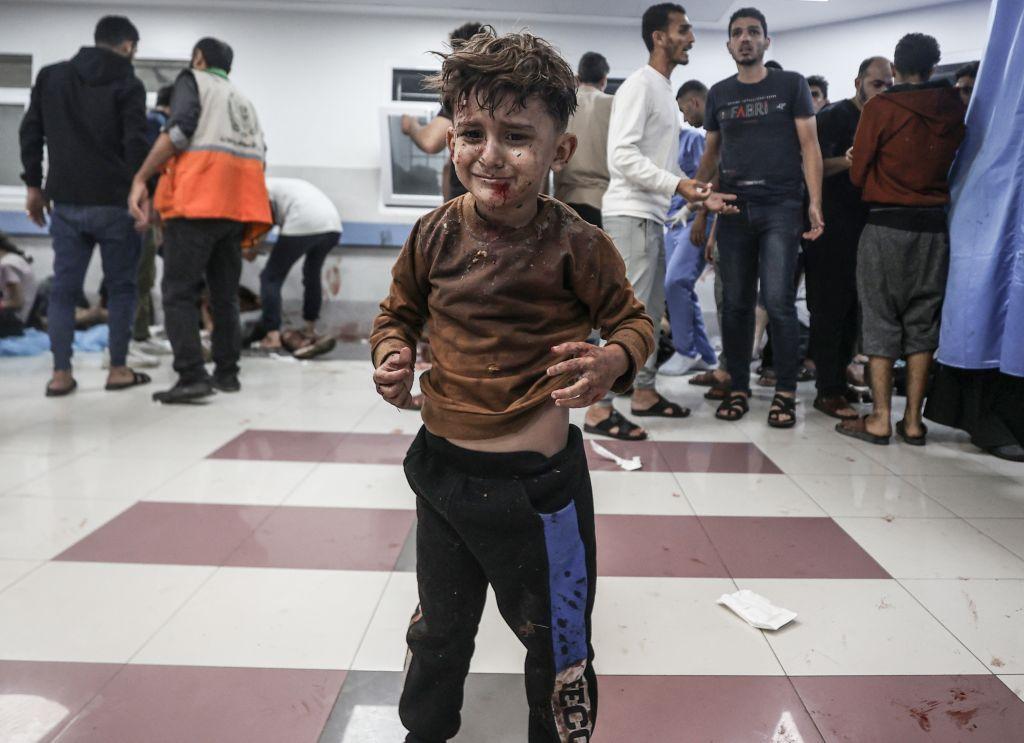 Un niño palestino herido en el hospital al Shifa, a donde fue trasladado luego del ataque aéreo sobre el hospital Bautista al Ahli en la ciudad de Gaza.