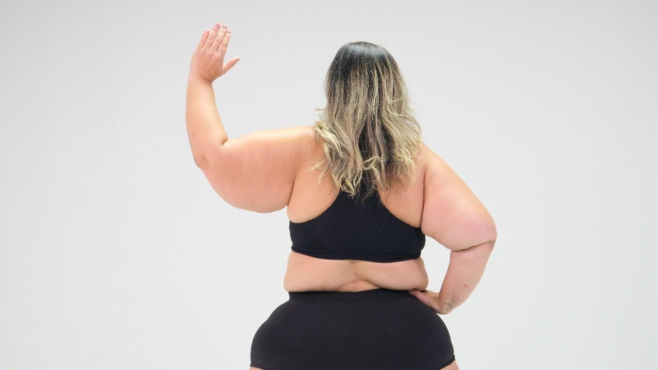 Mulher mostra braços afetados pelo lipedema