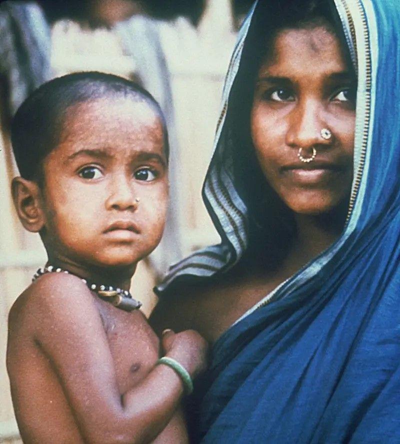 بنگلہ دیش میں 1975 میں تین سالہ رحیمہ بانو میں اس مرض کی تشخیص ہوئی تھی اور وہ اس کی آخری مریضہ تھیں