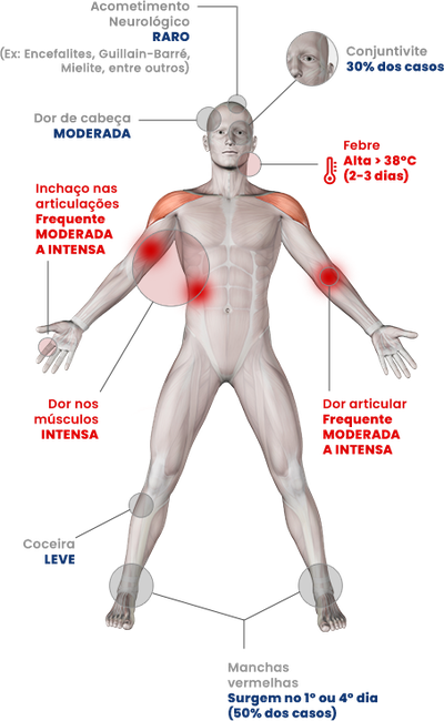 Imagem mostra principais sintomas da chikungunya