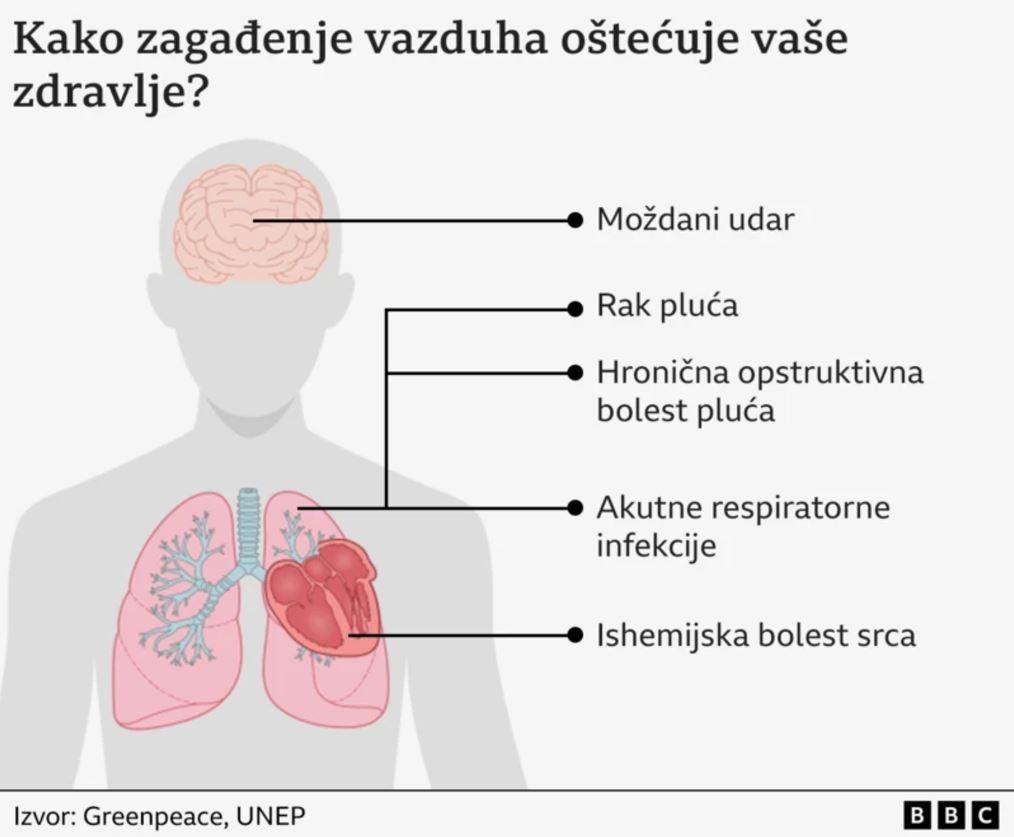 Ilustracija uticaja zagađenja na bolesti kod ljudi