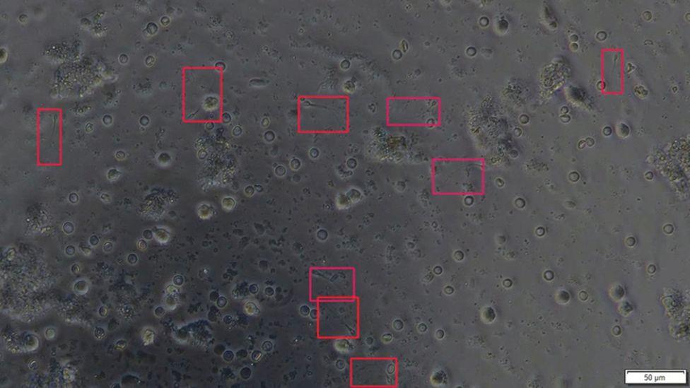 SpermSearch tespit ettiği spermlerin kırmızı kutuların içinde işaretliyor