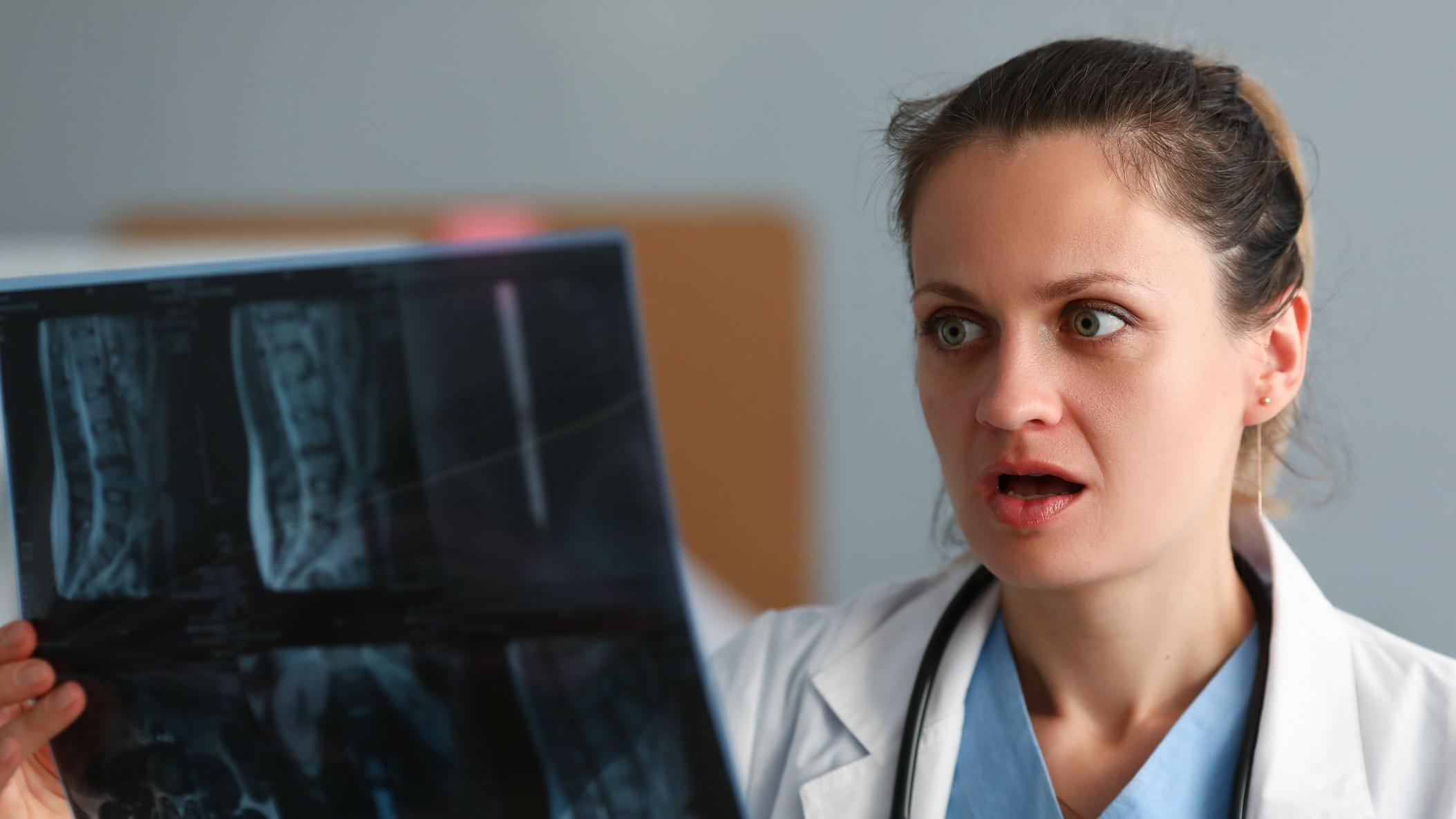 Una doctora soprendida por lo que ve en una imagen de rayos X