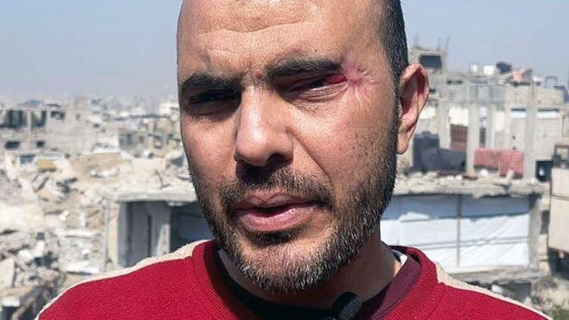 Homem com olho lesionado em frente a constru&ccedil;&otilde;es destru&iacute;das na Faixa de Gaza